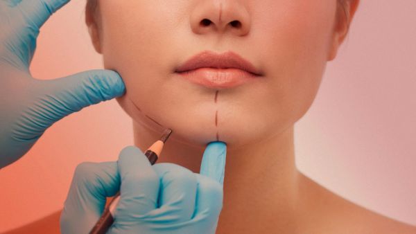 ¿Qué Es La Cirugía Estética?